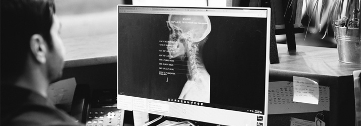 Chiropractor Bellingham WA Andrew Murry Looking At Whiplash Patient Xray Chiropractor Bellingham WA Andrew Murry Looking At Whiplash Patient Xray